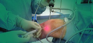Meniscus Cartilage Replacement Options Meniscus Cartilage Replacement Options